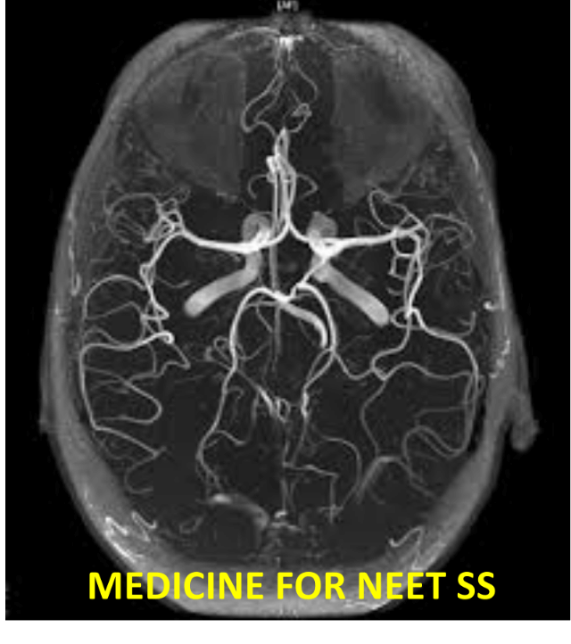 Neurology for NEET SS 2021